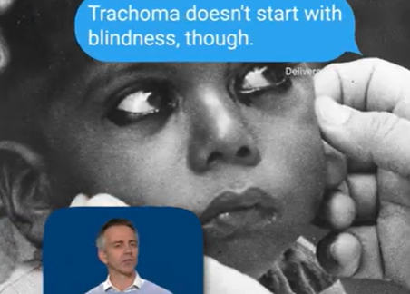 Did you know? Trachoma is the leading infectious cause of blindness worldwide-Thumbnail